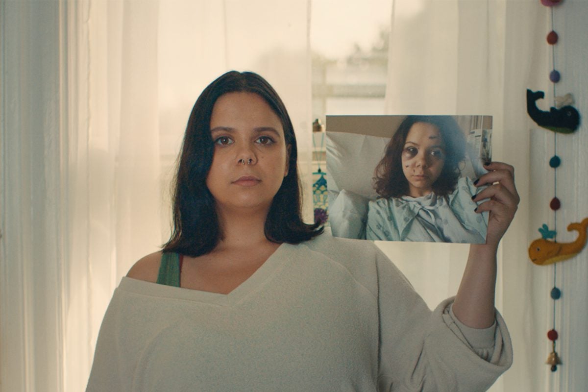Samantha Fuentes was shot in Parkland, Florida in 2018. Bullet fragments remain in her face and legs.